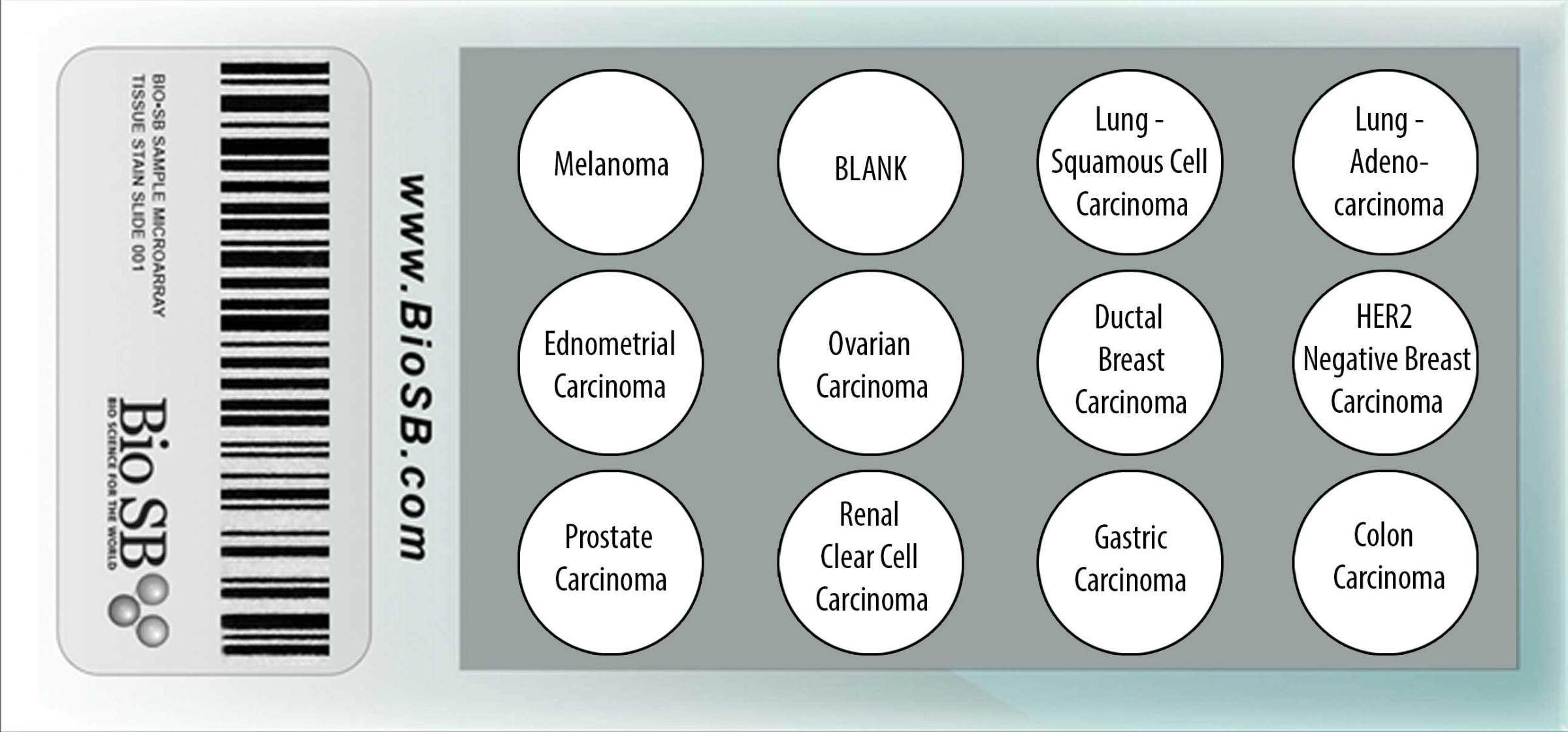 Cancer Human Tissue Microarrays