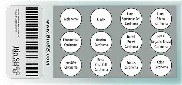 11 Core Human Cancer Tissue Microarray MAIN