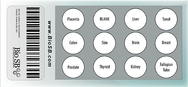 11 Core Normal Human Tissue Microarray MAIN