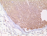 aspergillus, anti-aspergillus, Anti Aspergillus, A fumigatus MAIN