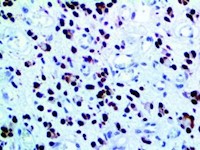 SOX-2 (EP103), RMab MAIN