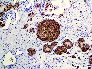 neun, anti neun, neu n, neu-n, anti-neu, (Feminizing Locus on X-3, Fox-3, or Hexaribonucleotide Binding Protein-3, anti- MAIN