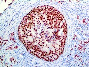 ER alpha, ESR1, sc8002, ERα, ERalpha, ER a, anti-Estrogen Receptor alpha, anti Estrogen Receptor alpha, anti-er, anti er THUMBNAIL