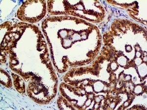 PTEN (RBT-PTEN), RMab MAIN