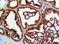 PTEN (RBT-PTEN), RMab MAIN