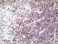 ATM, anti-atm, anti atm, Ataxia telangiectasia mutated protein MAIN