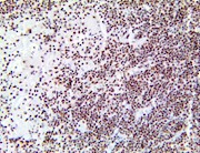 ATM, anti-atm, anti atm, Ataxia telangiectasia mutated protein THUMBNAIL