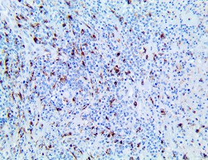 tia-1, anti-tia-1, tia1m anti-tia, tia, anti-tia, t-cell intracytoplasmic antigen, anti-t-cell MAIN