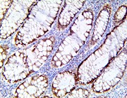 HSP70, hsp-70, anti-hsp70, anti-hsp-70, heat shock protein THUMBNAIL