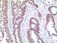 lamin-b1, lamin b1, lmnb1, lmn-b1, anti-lamin-b1, anti-lamin b1, anti-lmnb1, anti-lmn-b1 MAIN