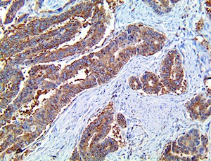 lamin-r, lamin r, anti-lamin-r, anti-lamin r, RPSA, anti-rpsa MAIN