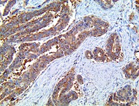 lamin-r, lamin r, anti-lamin-r, anti-lamin r, RPSA, anti-rpsa MAIN