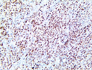 MNDA, anti-mnda, Myeloid cell Nuclear Differentiation Antigen, anti-Myeloid cell Nuclear Differentiation Antigen MAIN