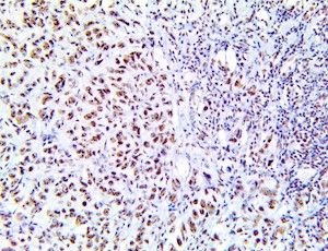 pelp, anti-pelp, hmx3, anti-hmx3, Proline-, glutamic acid- and leucine-rich protein 1 MAIN