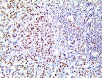 pelp, anti-pelp, hmx3, anti-hmx3, Proline-, glutamic acid- and leucine-rich protein 1 MAIN