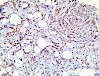 tim-3. tim3, anti-tim-3, anti-tim3, HAVCR2, anti-HAVCR2, CD366, anti-CD366, anti havcr2, anti cd366 MAIN