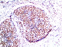 ini-1, anti-ini-1, ini1, anti-ini1,, smarcb1, anti-smarcb1, baf47, anti-baf-47, hsnf5, anti-hsnf5 MAIN