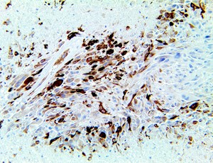 idh1, anti-idh1, r132h, anti-r132h, idh-1, idh 1, anti-idh-1, anti-idh MAIN