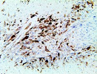 idh1, anti-idh1, r132h, anti-r132h, idh-1, idh 1, anti-idh-1, anti-idh MAIN