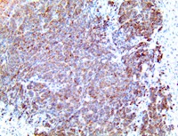cxcl12, anti-cxcl12, sdf-1, anti-sdf-1, sdf1, anti-sdf1, cytokine c-x-c motif chemokine 12, anti-cytokine MAIN