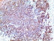cxcl12, anti-cxcl12, sdf-1, anti-sdf-1, sdf1, anti-sdf1, cytokine c-x-c motif chemokine 12, anti-cytokine THUMBNAIL