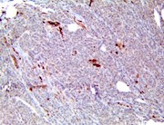 caspase-3, anti-caspase-3, caspase3, caspase 3, anti-caspase, casp3, anti-casp3, casp-3, anti-casp-3 THUMBNAIL