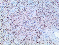 hhv8, hhv-8, hhv 8, anti-hhv8, anti-hhv8, anti hhv-8, anti-hhv-8, Kaposi s sarcoma associated herpesvirus, KSHV, eighth MAIN