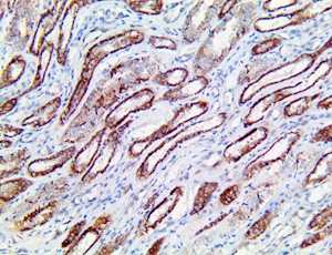 fumarate hydratase, fumurase, anti-fumurate hydratase, anti-fumurase, fh, anti-fh MAIN