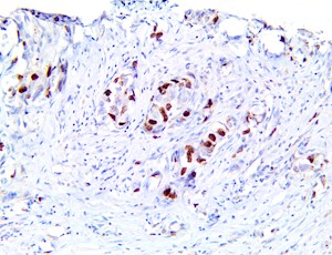 aurora b, anti-aurora b, aurora b kinase MAIN