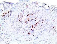 aurora b, anti-aurora b, aurora b kinase MAIN