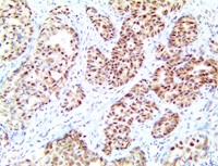 tdp43, tdp-43, tdp 43, anti-tdp43, anti-tdp-43, anti-tdp 43, tardbp, anti-tardbp, transactive response dna binding prote MAIN
