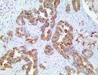 cxcr5, anti-cxcr5, cd185, anti-cd185, g-protein coupled receptor,anti-g-protein, gpcr, anti-gpcr MAIN