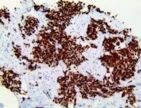 insm-1, anti-insm1, anti insm1, anti-insm1, IA 1, IA1, insulinoma associated 1, insulinoma associated protein 1, INSM1, MAIN