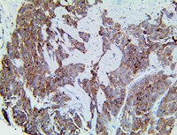 CXCR4, anti-cxcr4, cd184, anti-cd184, fusin, anti-fusin, chemokine receptor 4, anti-chemokine MAIN