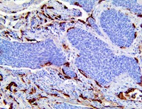 surfactant protein D, anti surfactant, sp-d, spd, anti-sp-d anti-spd, sp d MAIN