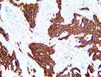 somatostatin receptor 2, sstr2, anti-somatostatin receptor 2, anti-sstr2, MAIN