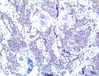 pygopus 2, pygo2, anti-pygopus 2, pygopus-2, anti-pygo2, anti-pygo 2, pygo 2, anti pygo-2, pygo-2 MAIN