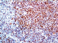 SOX-11 (CL0142), MMab MAIN