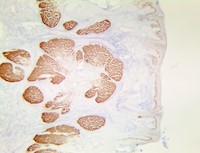 TintoFast PRAME (RBT-PRAME), RMab MAIN