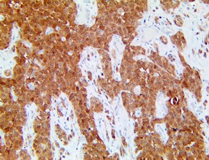 TintoFast Chromogranin A (LK1H10), MMab MAIN