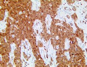 TintoFast Chromogranin A (LK1H10), MMab THUMBNAIL
