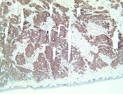 TintoFast Synaptophysin (Polyclonal), RPab THUMBNAIL