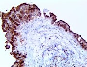heg1, heg 1, heg-1, anti-heg1, anti-heg 1, anti-heg-1, Sialylated protein HEG homolog 1, Heart development protein with THUMBNAIL