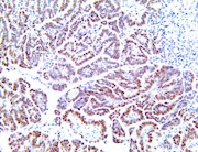 arid1a, anti-arid1a, arid, anti-arid THUMBNAIL