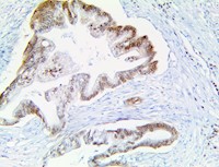 musashi 2, anti-musashi 2, mushashi-2, anti-musashi-2, msi2, anti-msi2 MAIN