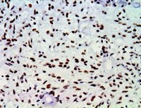 atrx, anti-atrx, α-thalassemia mental retardation syndrome X-linked MAIN