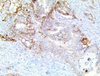 trop-2, trop2, anti-trop-2, anti-trop2, egp-1, egp1, anti-egp-1, anti-egp1 MAIN