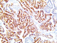 ifn-a, anti-ifn-a, ifna, anti-ifna, ifn a, anti-ifn a, IFN-α, anti-IFN-α, inf alpha, ifn-alpha, anti-ifn-alpha MAIN