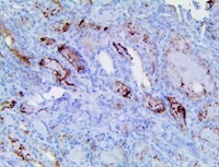 cd73, anti-cd73, nt5e, anti-nt5e, Ecto-5’-nucleotidase, anti-Ecto-5’-nucleotidase MAIN