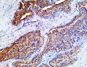 annexin viii, annexin 7, anx7, anxvii, anti-annexin viii, anti-annexin 7, anti-anx7, anti-anxvii, antibody, antibody, ih MAIN